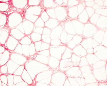 flyd-aef71KyW0JI-unsplash